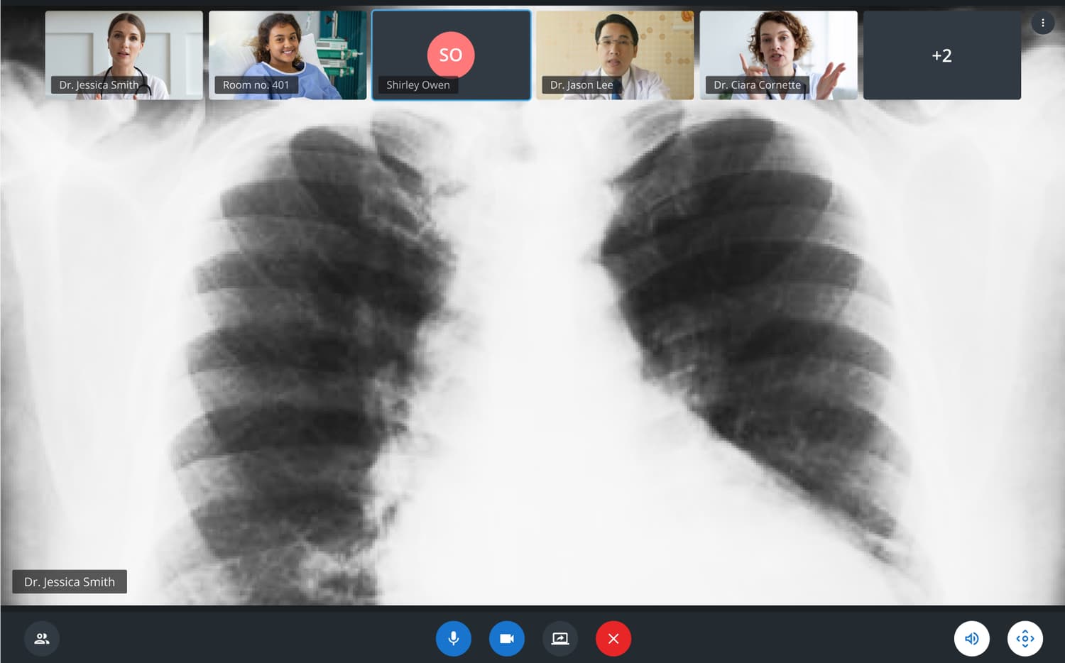 Provider-side virtual rounding call with participant list, camera controls and a shared X-ray image